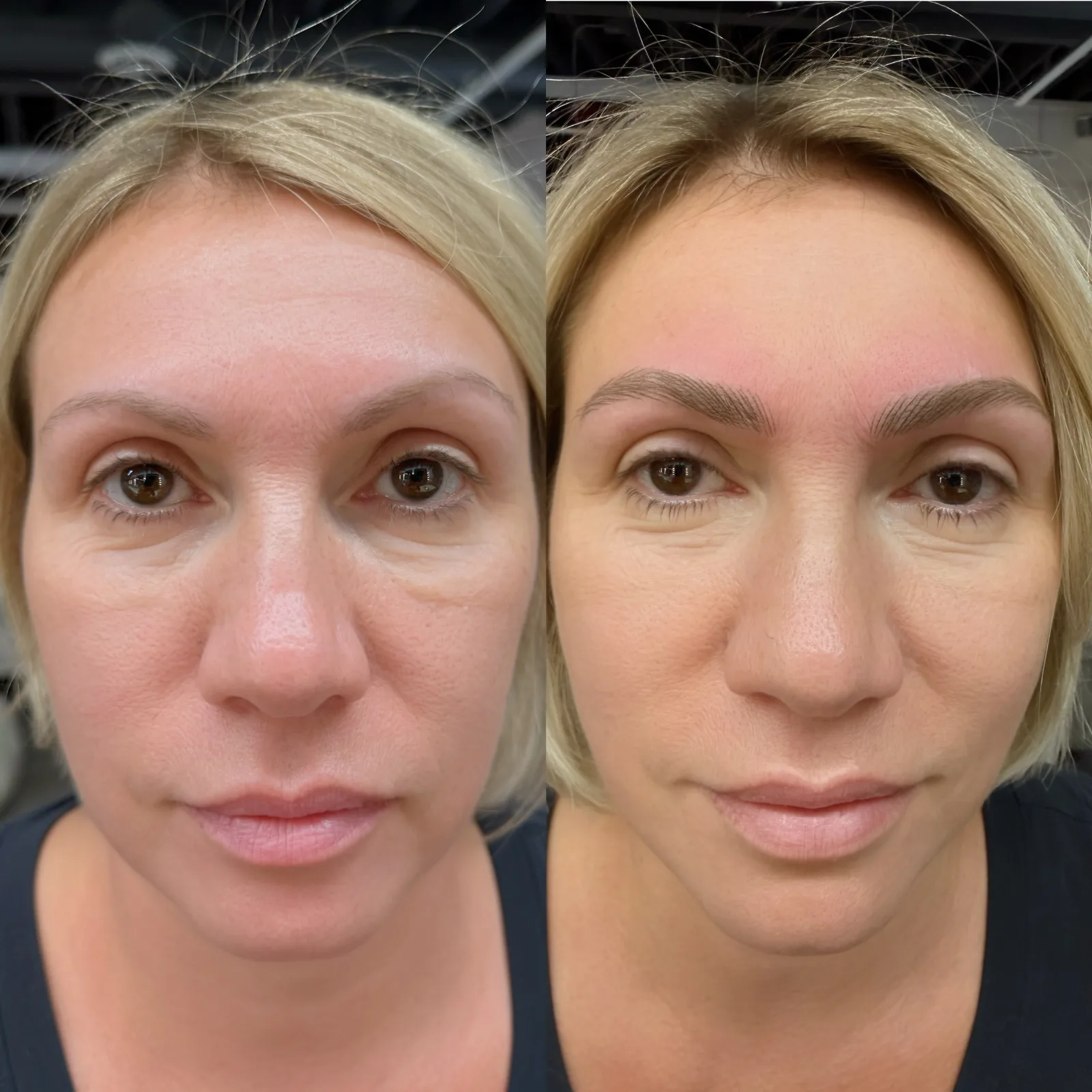 Nano Brows before and after at Microblading LA: sparse light brows become fuller, soft-arched medium brown hair-stroke brows