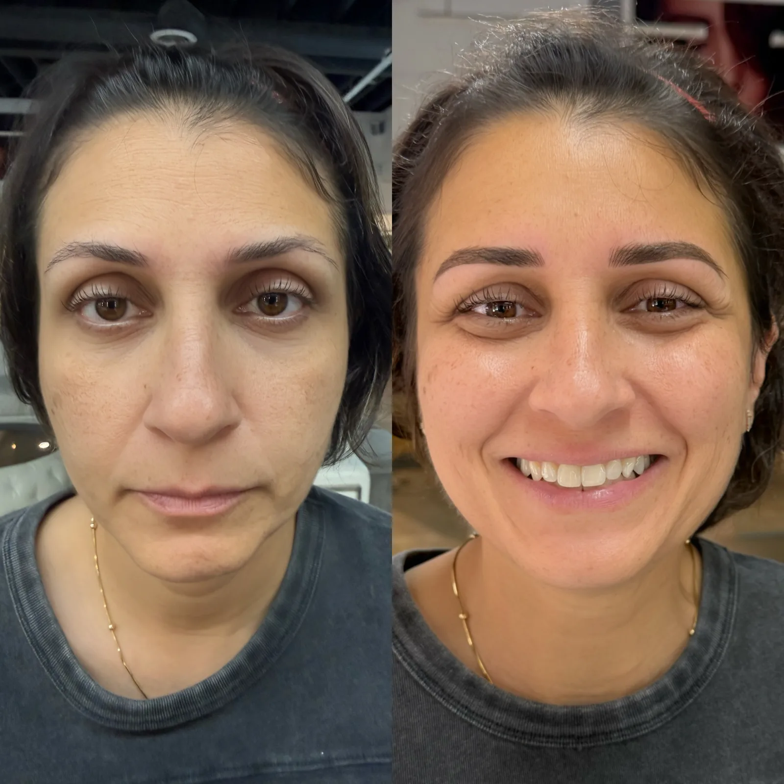 Nano Brows before and after at Microblading LA: sparse, faint brows become fuller, softly arched dark brown brows