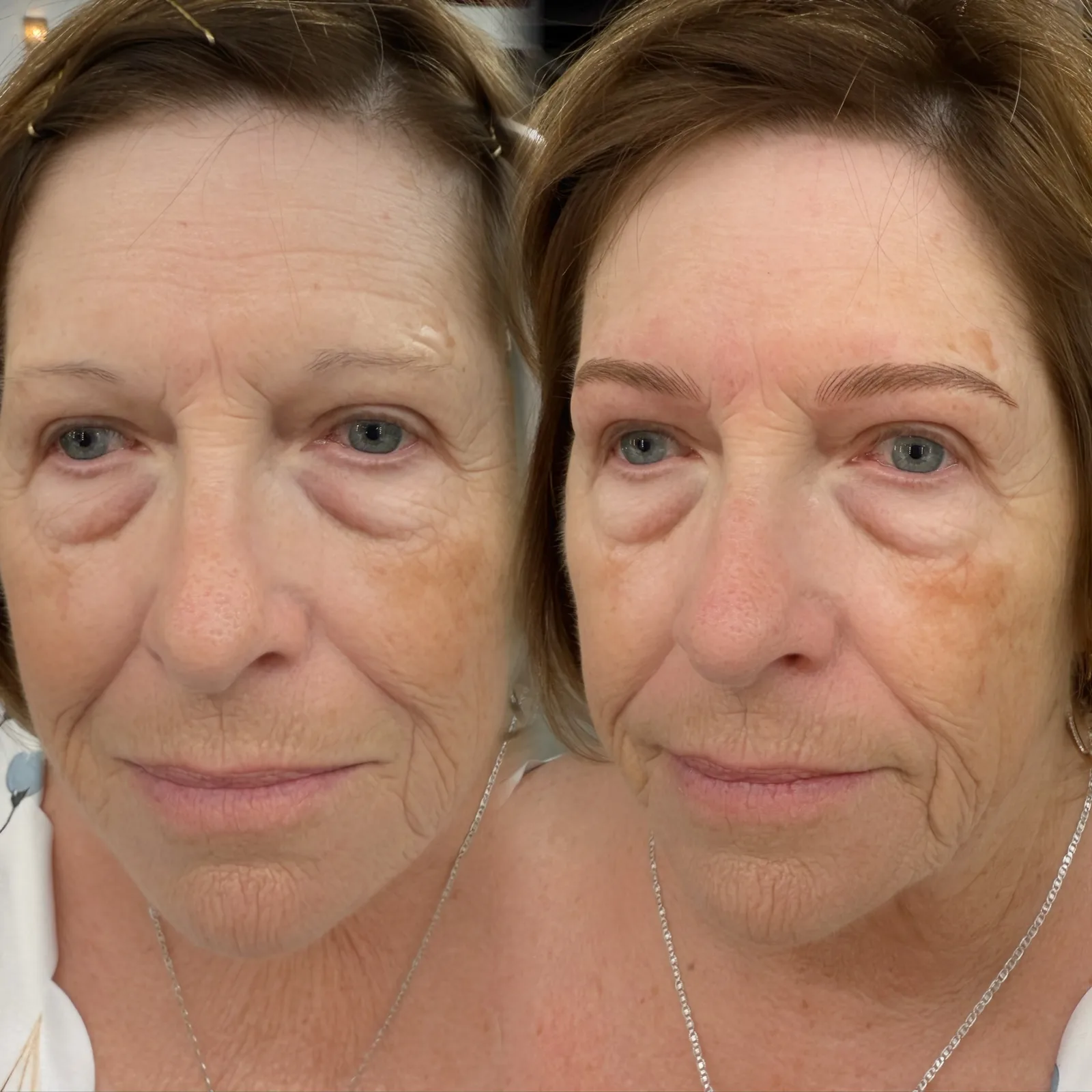 Nano Brows before and after at Microblading LA: sparse, faint brows transformed into soft, defined arches in warm brown